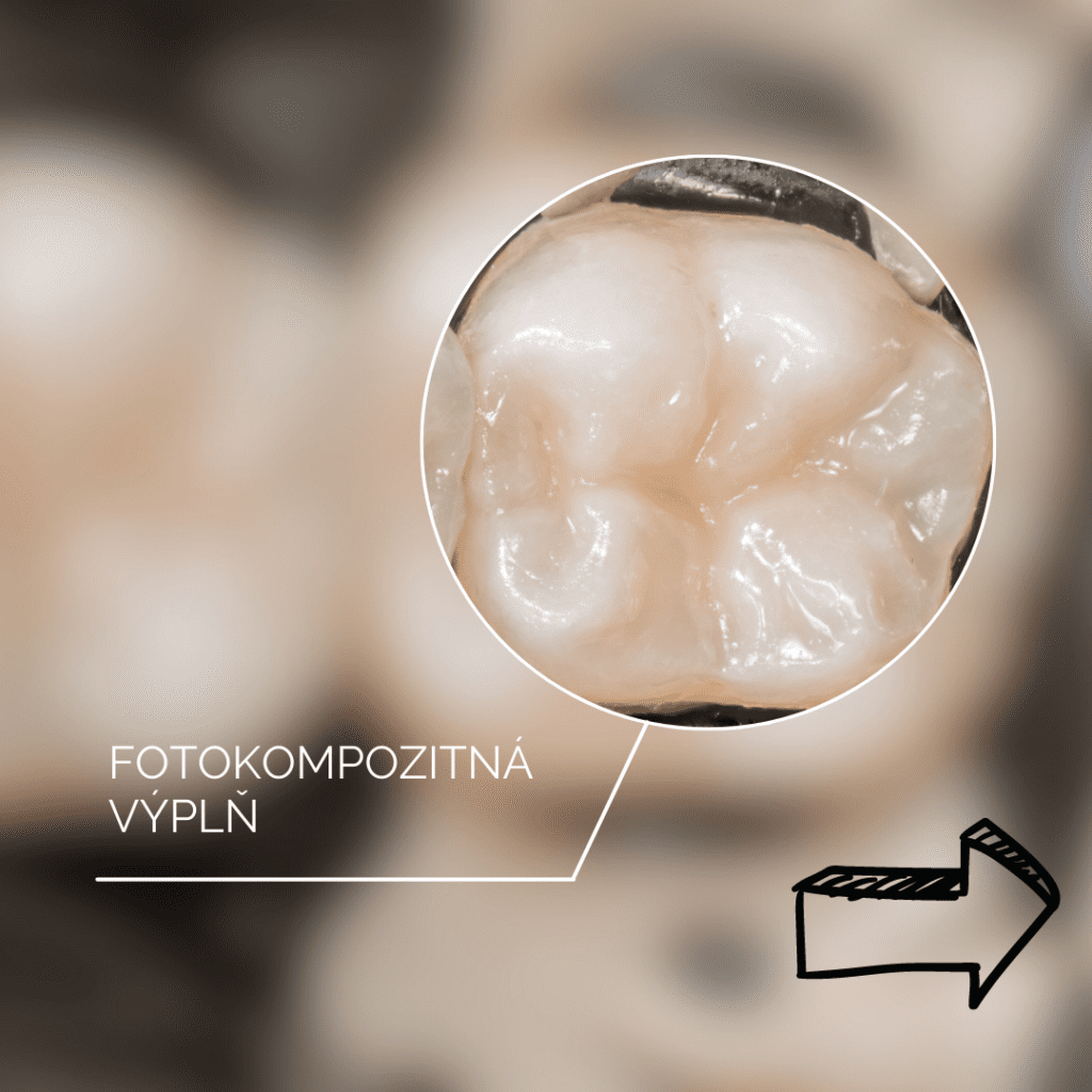 Čo je fotokompozit a prečo je taký obľúbený? – fotokompozit